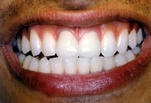 finale foto sorriso
