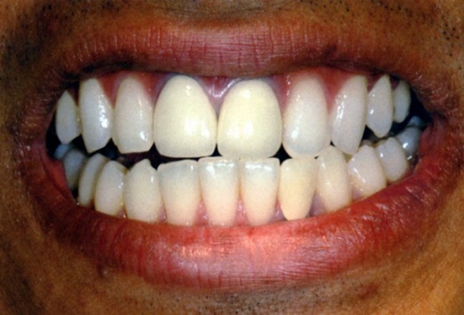 iniziale foto sorriso